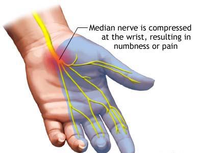 nerve test emg painful