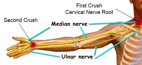 nerve test on arm painful